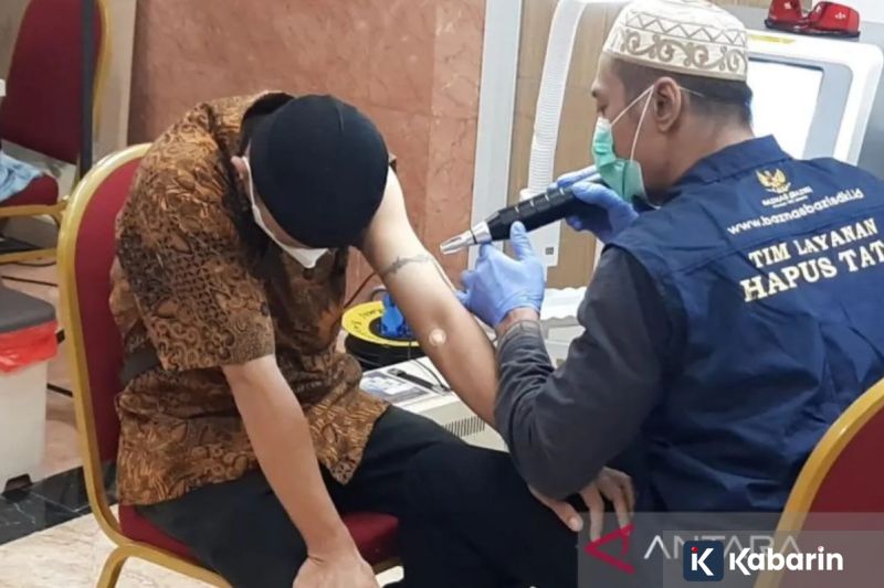 Baznaz DKI Buka Layanan Hapus Tato Gratis Mulai 23 Februari 2026